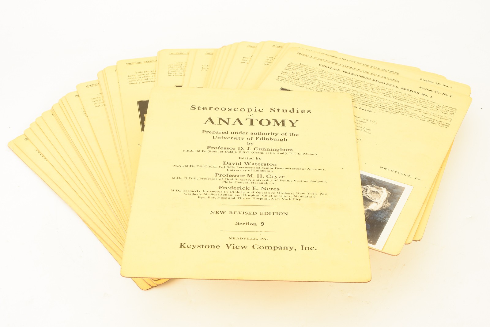 Stereoscopic Studies of Edinburgh Internal Face Section 9 No Case 39 Cards V21