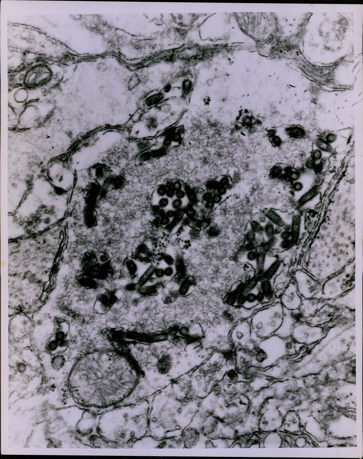 LG871 1971 Original Photo CENTER FOR DISEASE CONTROL Atlanta Microscopic View LG871 1971 Original Photo CENTER FOR DISEASE CONTROL Atlanta Microscopic View