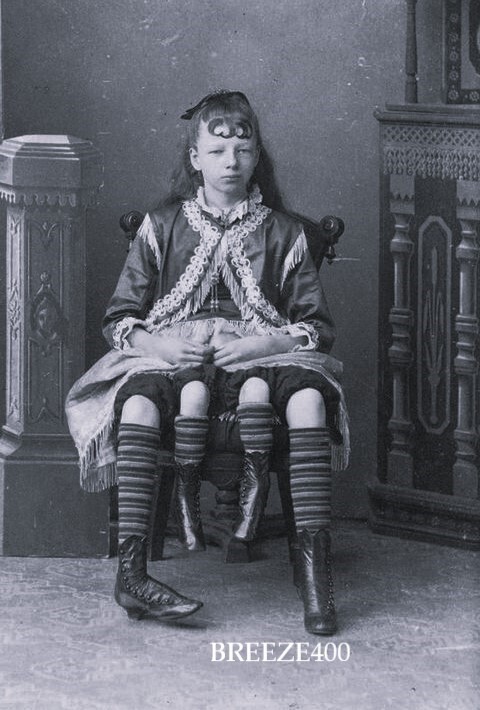 CIRCUS-CARNIVAL-SIDESHOW PHOTO/Early 1900\'s/THE 4 FOUR-LEGGED GIRL/4x6 B&W Rpt.
