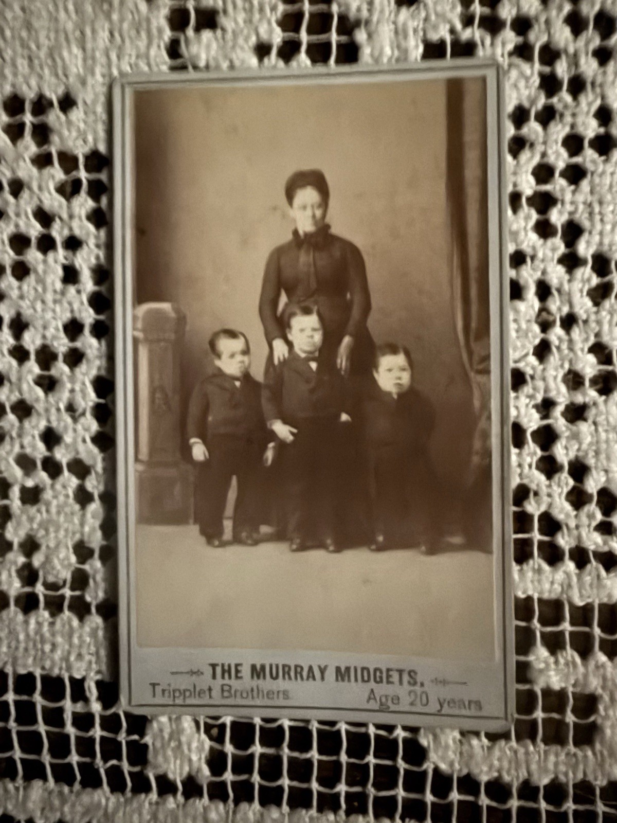 CDV of the Murray Midgets “Triplett Brothers” Age 20 years Barnum Circus 1860’s