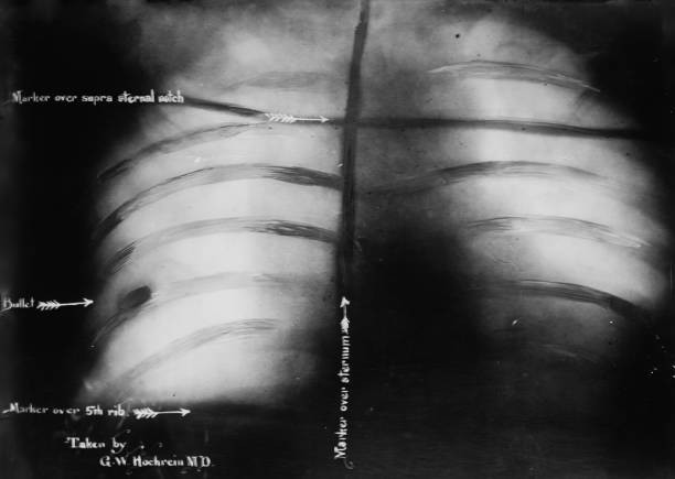 Theodore Roosevelt\'s chest x-ray after John F Schrank\'s attempted - Old Photo
