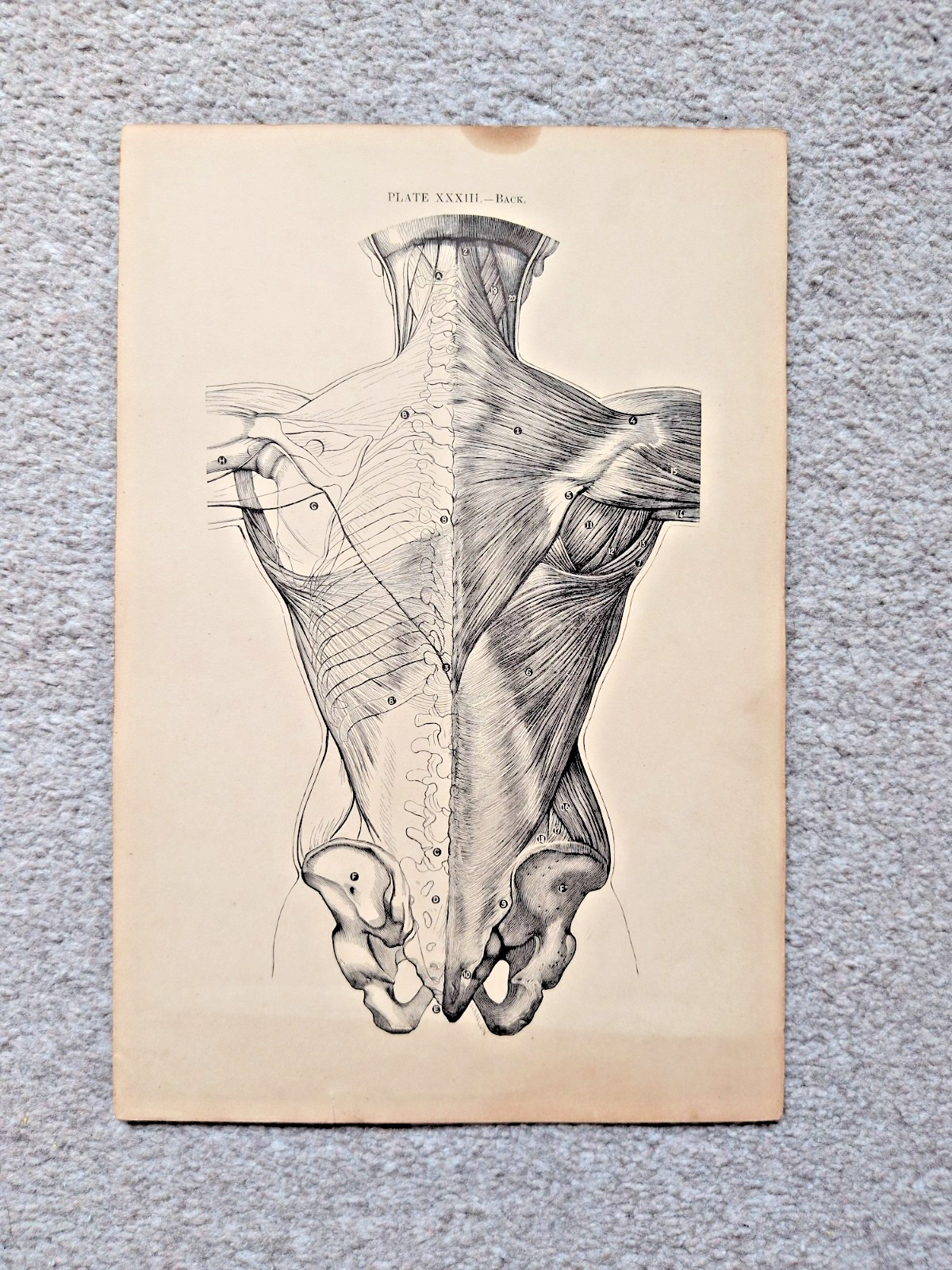 Back - Antique Anatomy Print - 1888