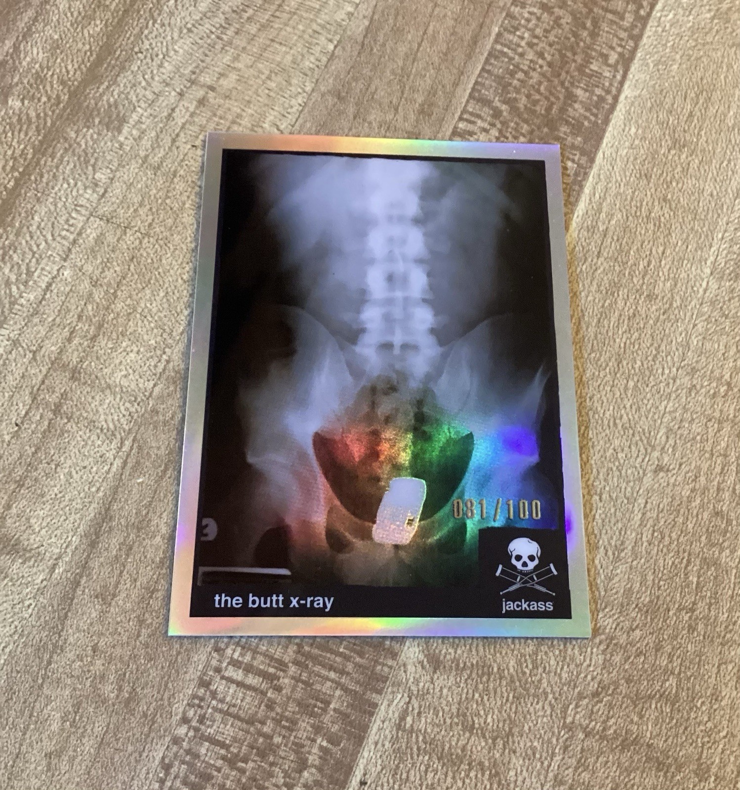 2022 ZEROCOOL JACKASS CARD STUNTS #s-3 THE BUTT X-RAY SILVER HOLO /100 RYAN DUNN