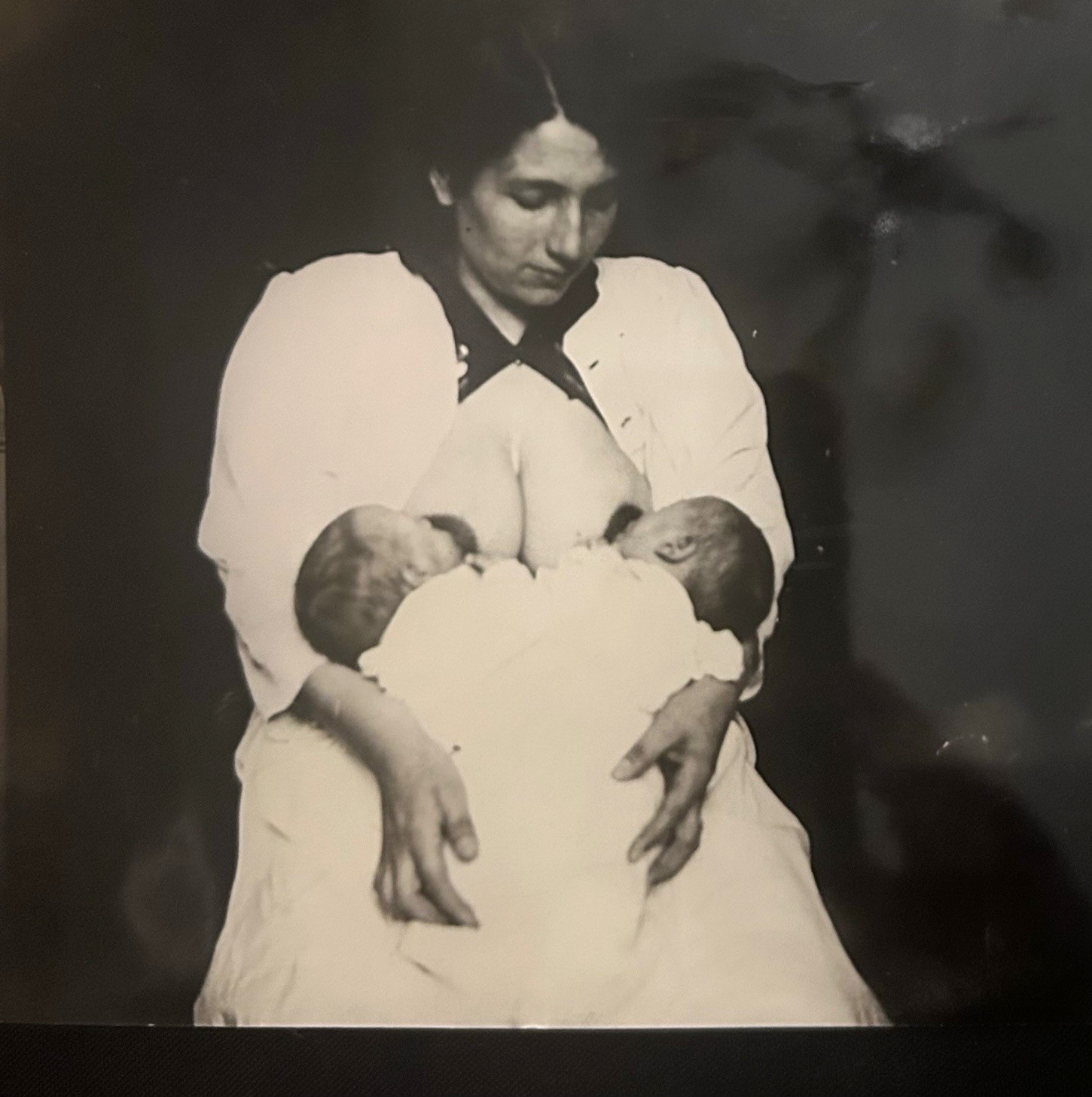 1921 Vintage Copy Photo Suzanne Madeleine Conjoined Twins Xiphopagus France