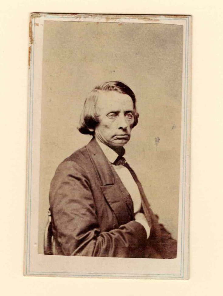 ORIG. CDV PHOTO of Tennessee Methodist Minister PARSON BROWNLOW by Mathew Brady