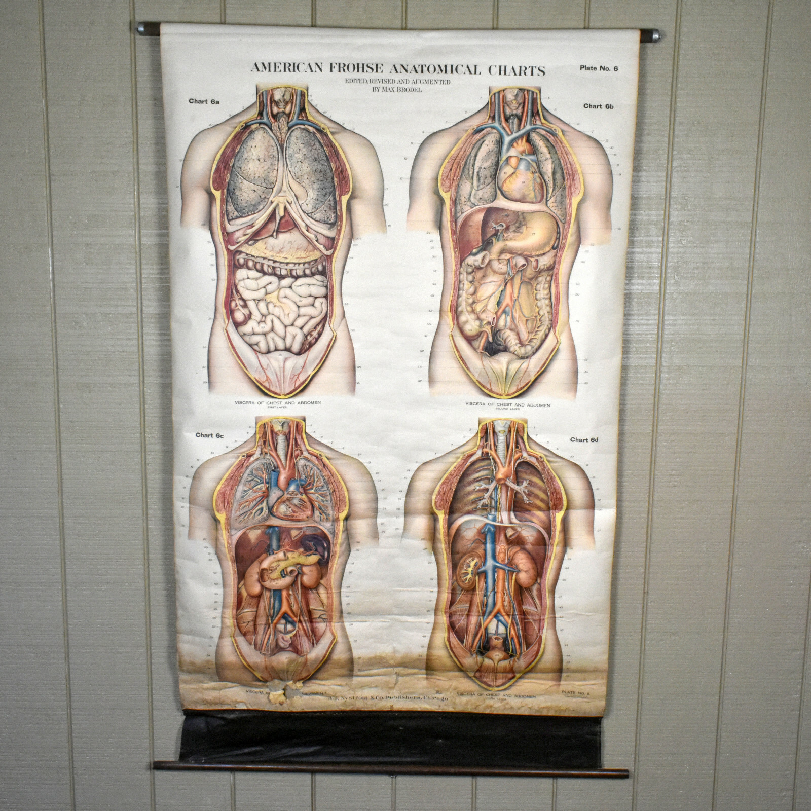 VTG American Frohse Anatomical Chart No 6 Chest and Abdomen 1918 Max Brodel