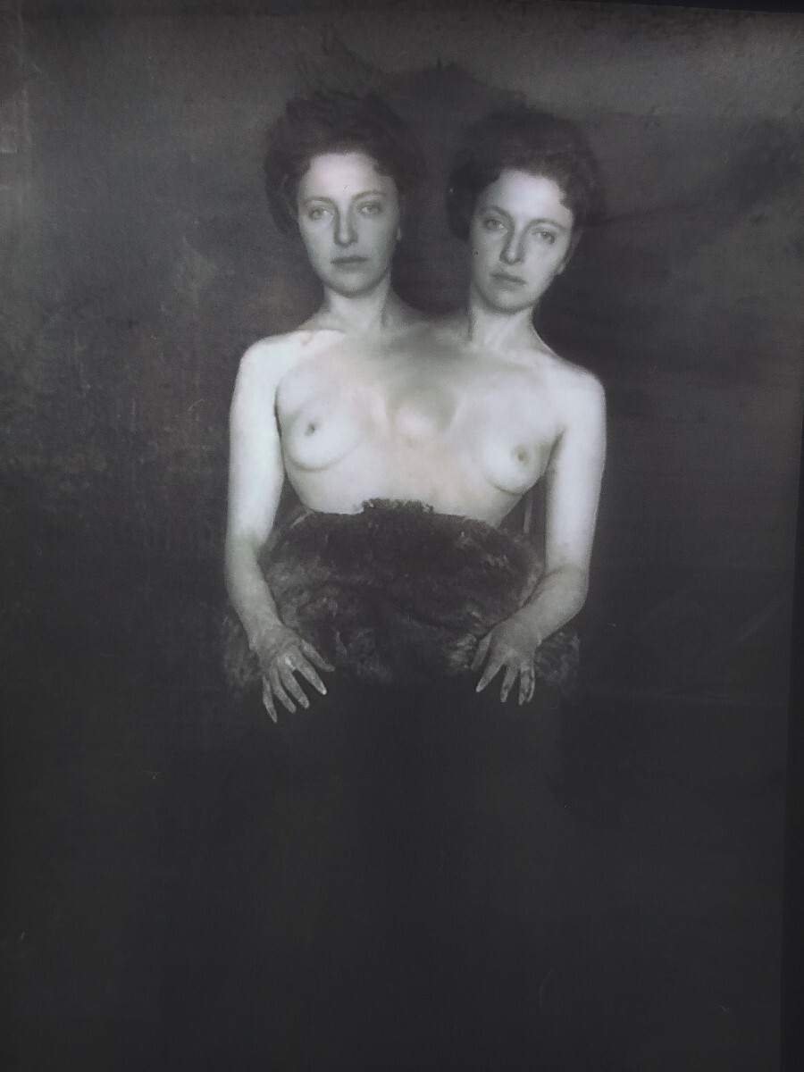 VINTAGE - NEGATIVE -  Siamese twins -  CIRCUS SHOW - HORROR - FREAK
