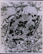 LG871 1971 Original Photo CENTER FOR DISEASE CONTROL Atlanta Microscopic View picture