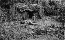 Children With Sleeping Sickness 1900s OLD PHOTO picture