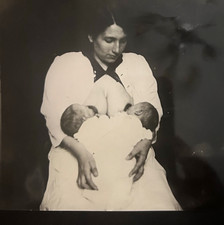 1921 Vintage Copy Photo Suzanne Madeleine Conjoined Twins Xiphopagus France picture