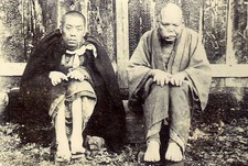 GROTESQUE Antique DEFORMITY DISEASE LEPROSY Rare PHOTO 1870 Expedition FREAKS picture