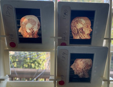 3 Glass  Slides    Human Heads medical Illustration picture