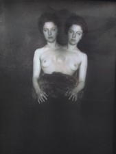 VINTAGE - NEGATIVE -  Siamese twins -  CIRCUS SHOW - HORROR - FREAK picture