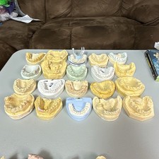 20 Dental Odd Plaster Real Tooth Teeth Molds Dentist Cast Impressions Vintage picture